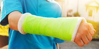 Do You Have To Wear A Cast For A Broken Wrist?